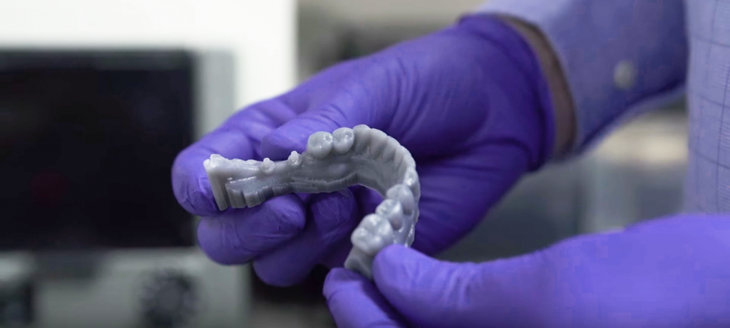 impressão 3D no setor odontológico molde 3D