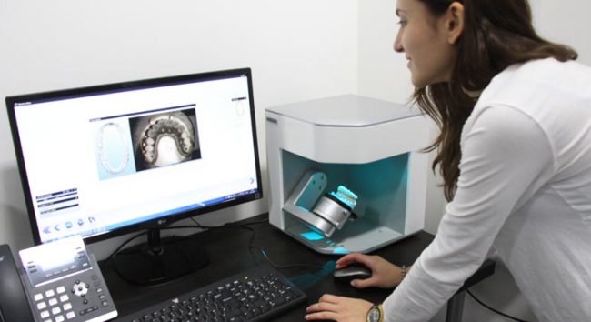impressão 3D no setor odontológico scanner 3D
